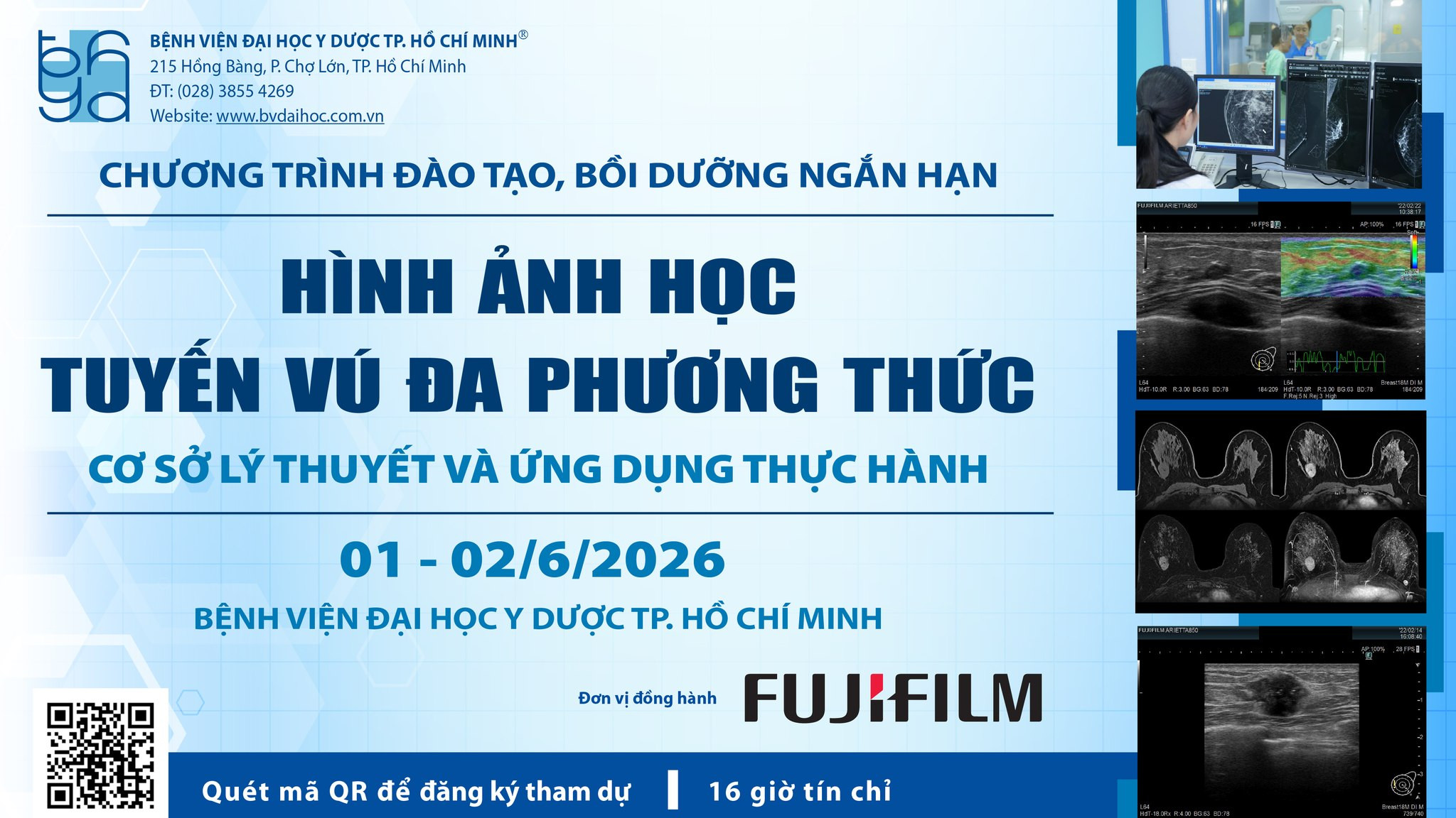Tuyến vú